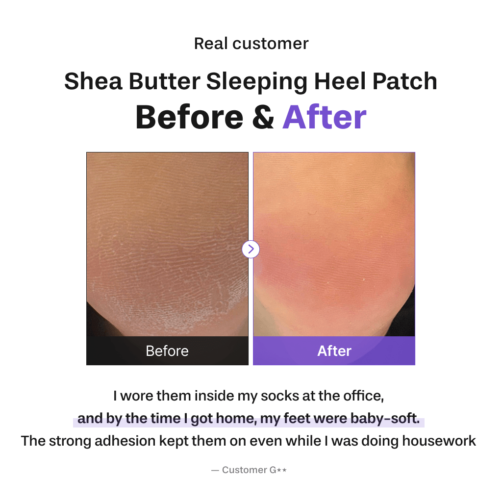 Baren Shea Butter Sleeping Heel Patch, 10pcs - OVERRATED