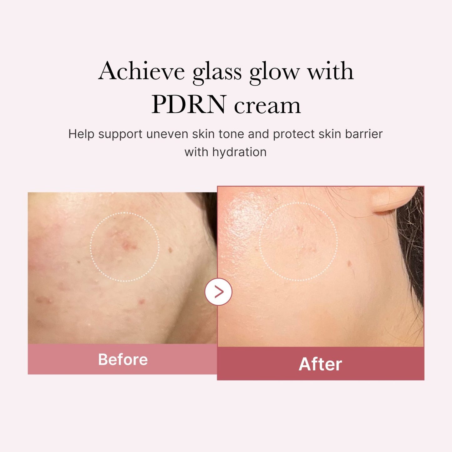 Medicube PDRN Pink Hyaluronic Moisturizing Cream