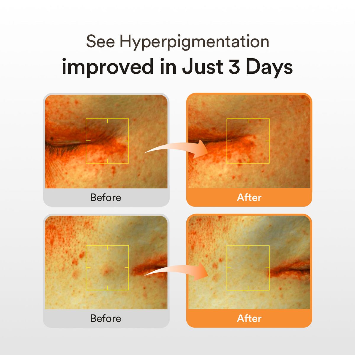 Abib Glutathiosome dark spot serum Vita drop - OVERRATED