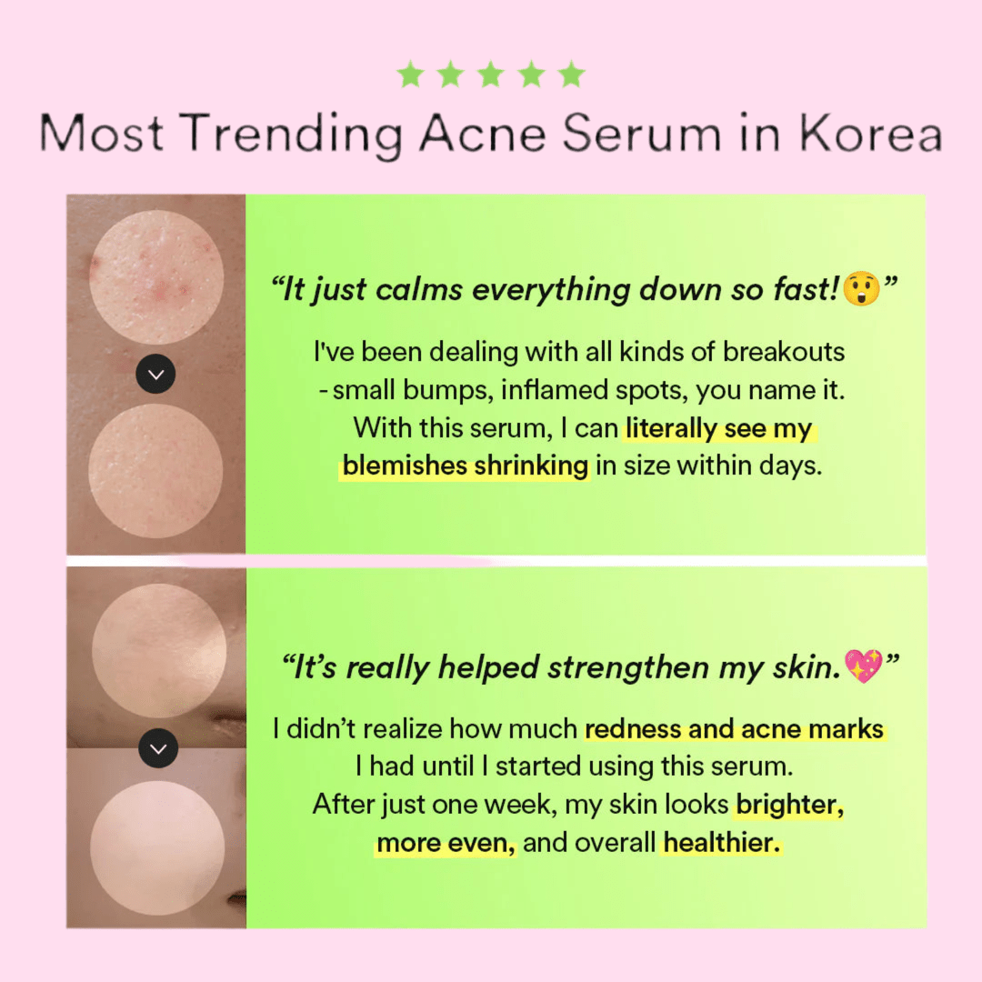 Abib Heartleaf Teca Capsule Serum Calming Drop - OVERRATED