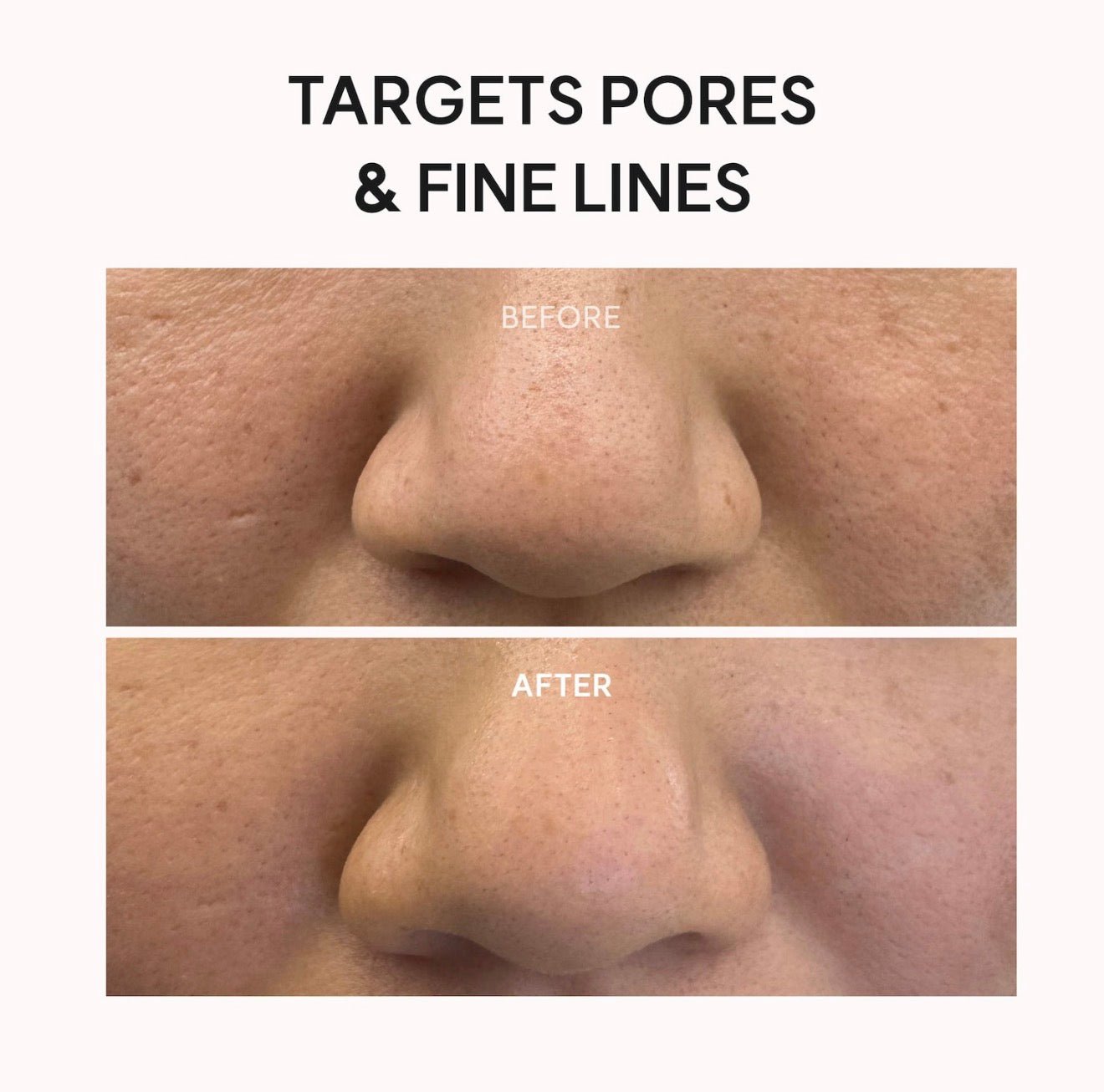 Arencia Red Collagen Jello Mask - OVERRATED