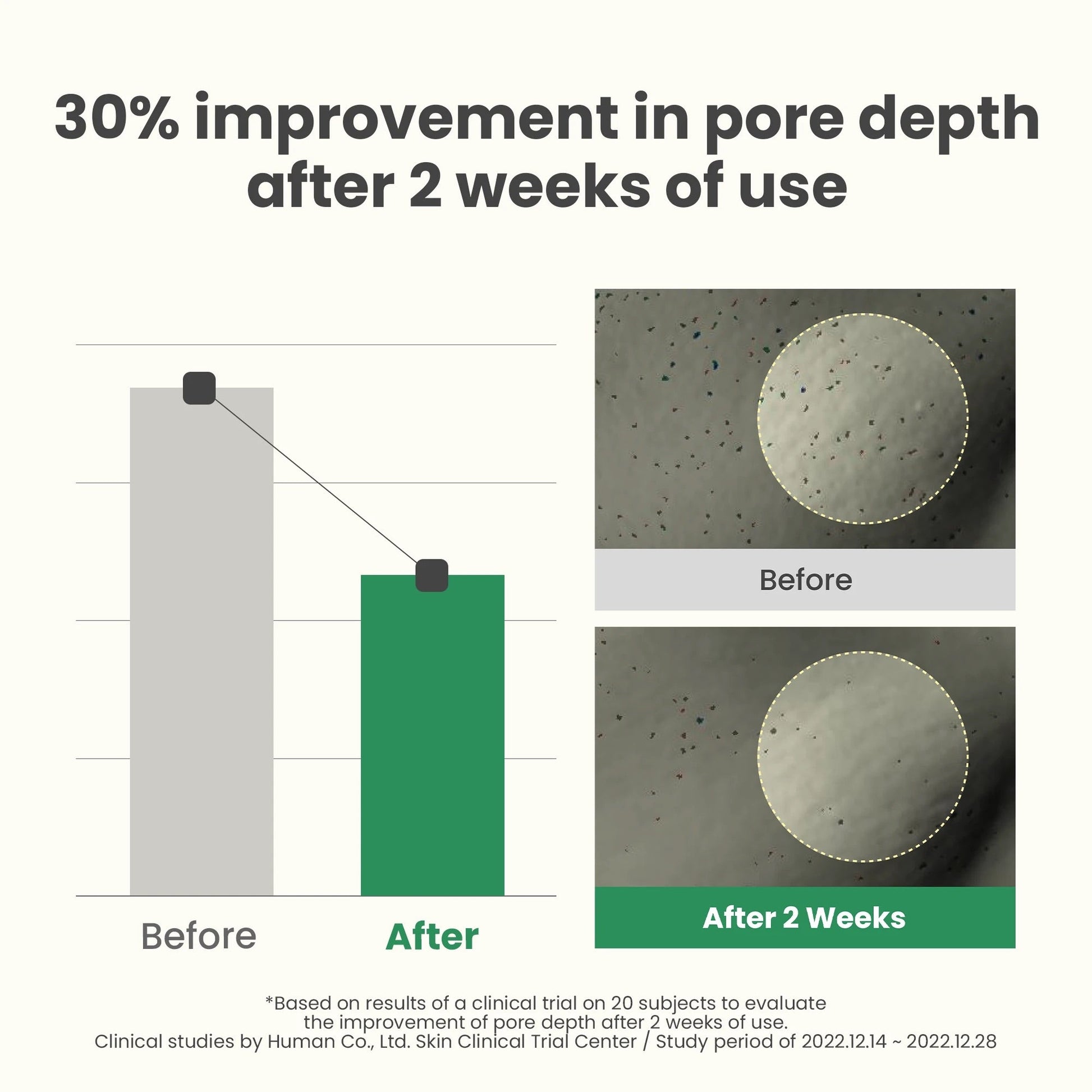 Axis - Y LHA Peel & Fill Pore Balancing Cream - OVERRATED