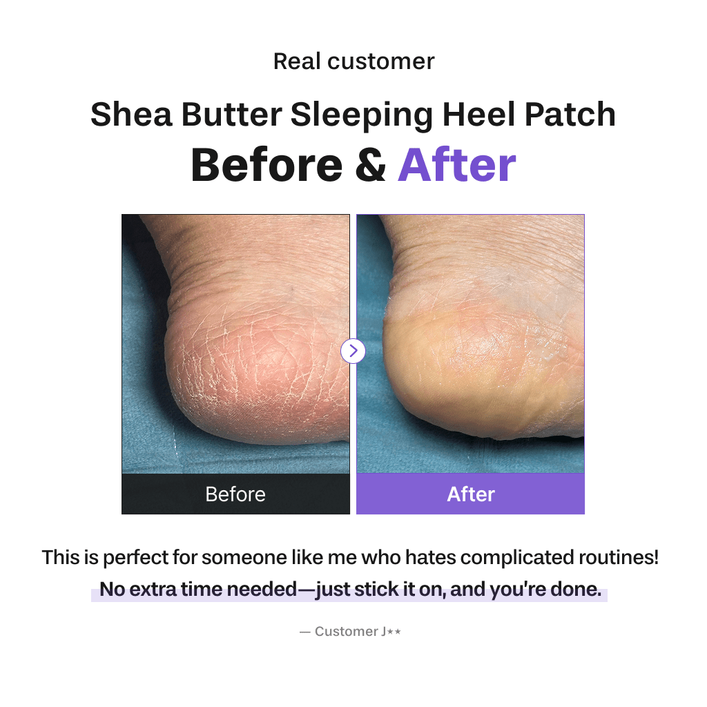 Baren Shea Butter Sleeping Heel Patch, 10pcs - OVERRATED