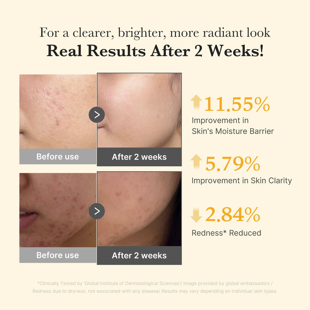 Medicube Kojic Acid Turmeric Capsule Serum - OVERRATED