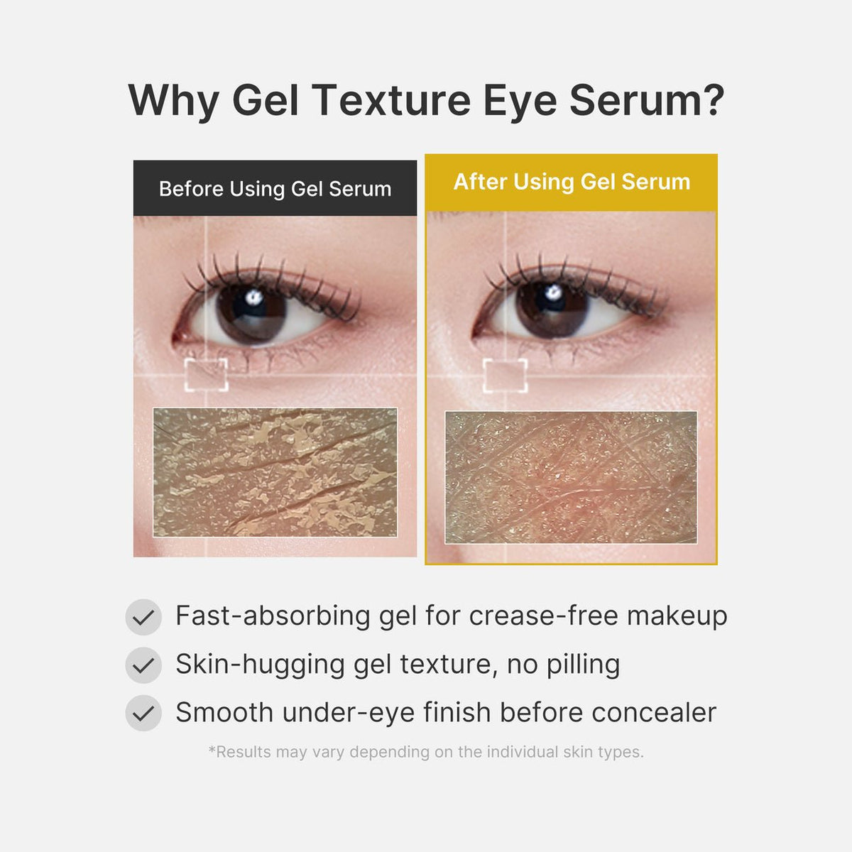 Medicube Kojic Acid Turmeric Eye Gel Serum - OVERRATED