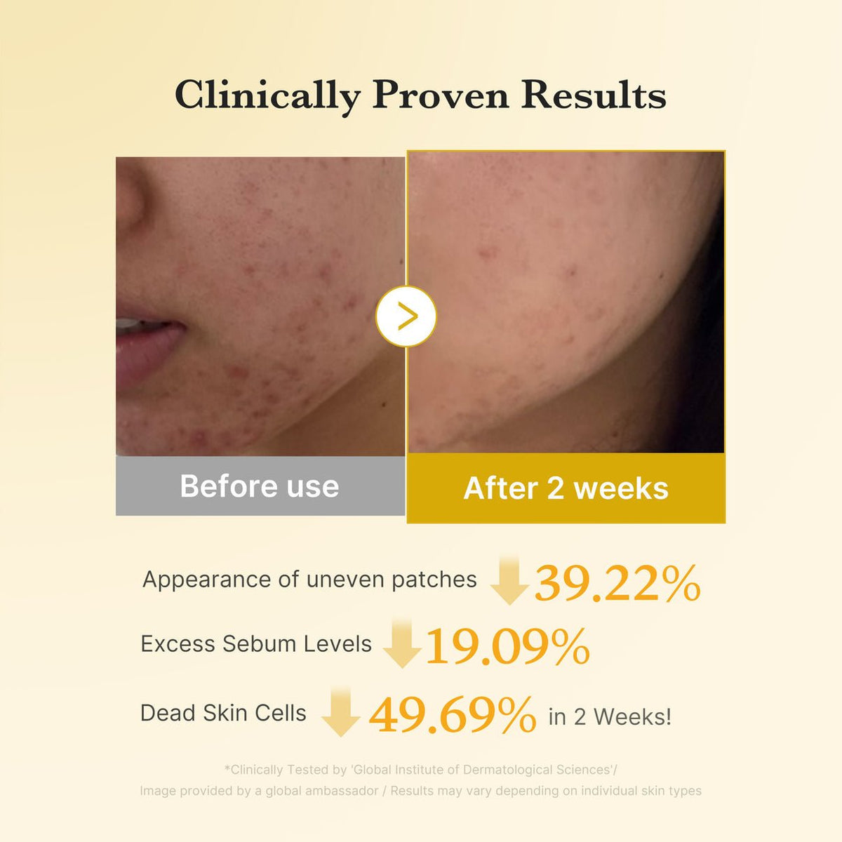 Medicube Kojic Acid Turmeric Toner Pad - OVERRATED