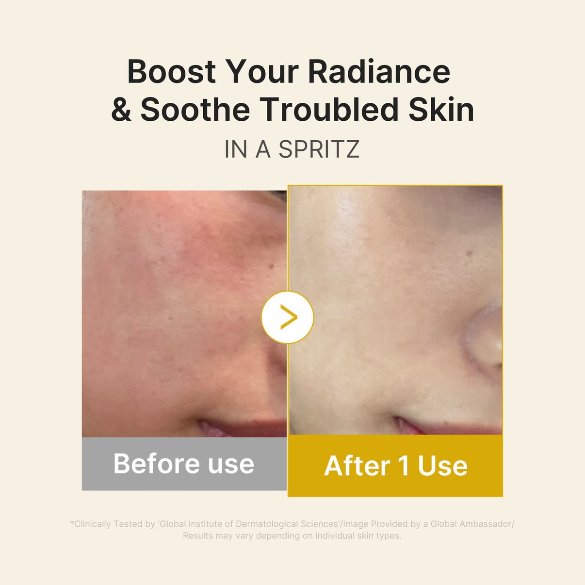 Medicube Kojic Acid Turmeric Vitamin Gold Jelly Mist Serum - OVERRATED