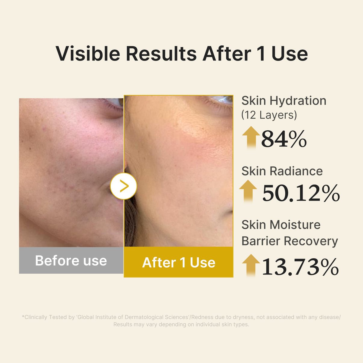 Medicube Kojic Acid Turmeric Vitamin Gold Jelly Mist Serum - OVERRATED