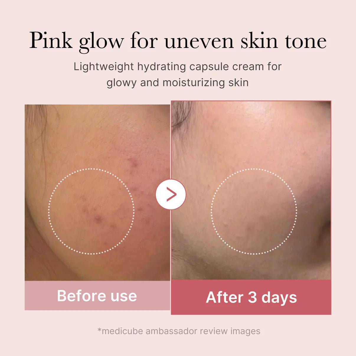 Medicube PDRN Pink Collagen Capsule Cream - OVERRATED