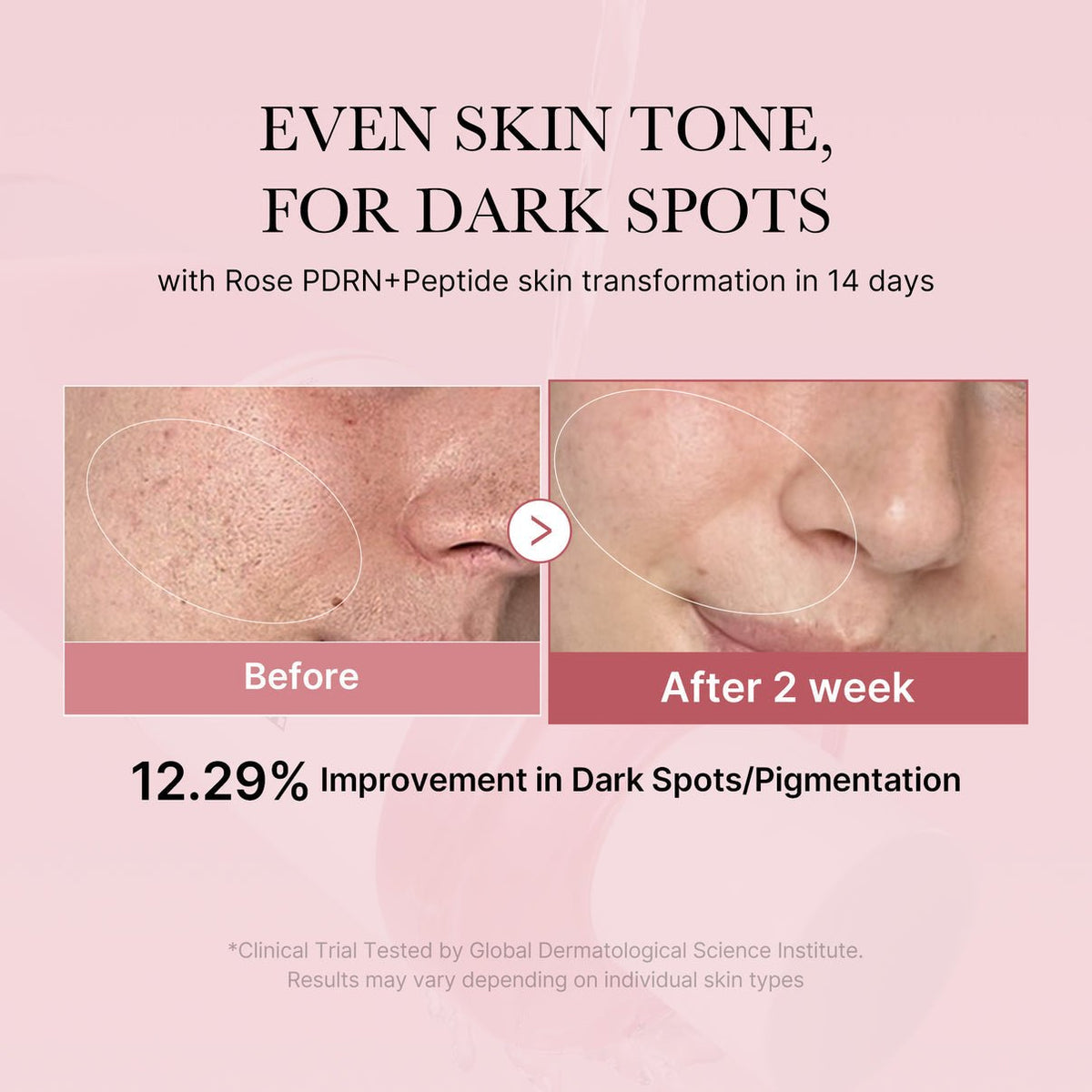 Medicube PDRN Pink Peptide Toner - OVERRATED