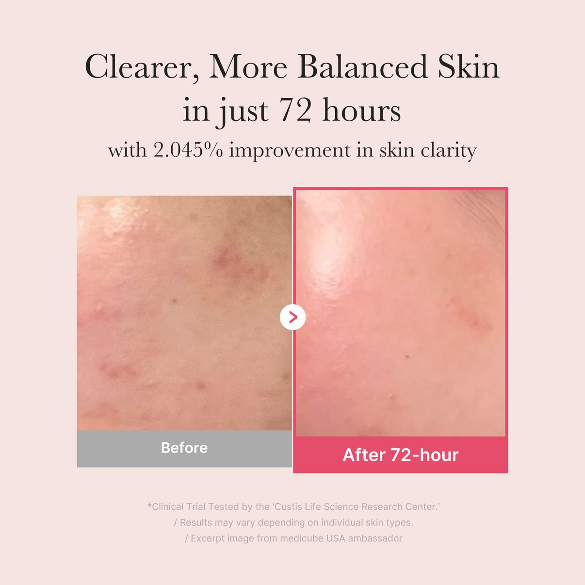 Medicube TXA Niacinamide Serum - OVERRATED