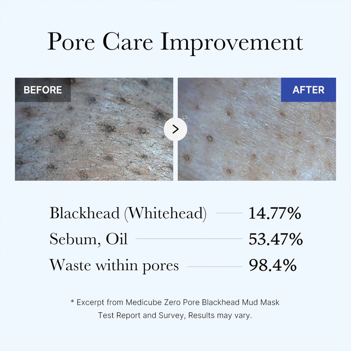 medicube Zero Pore Blackhead Mud Mask - OVERRATED