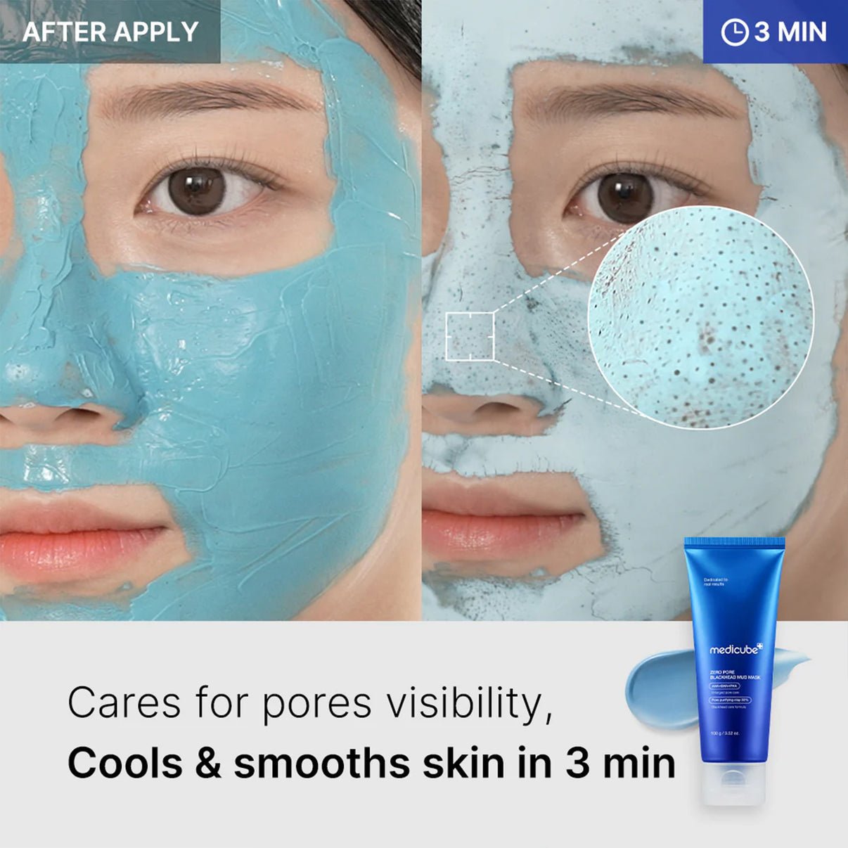 medicube Zero Pore Blackhead Mud Mask - OVERRATED