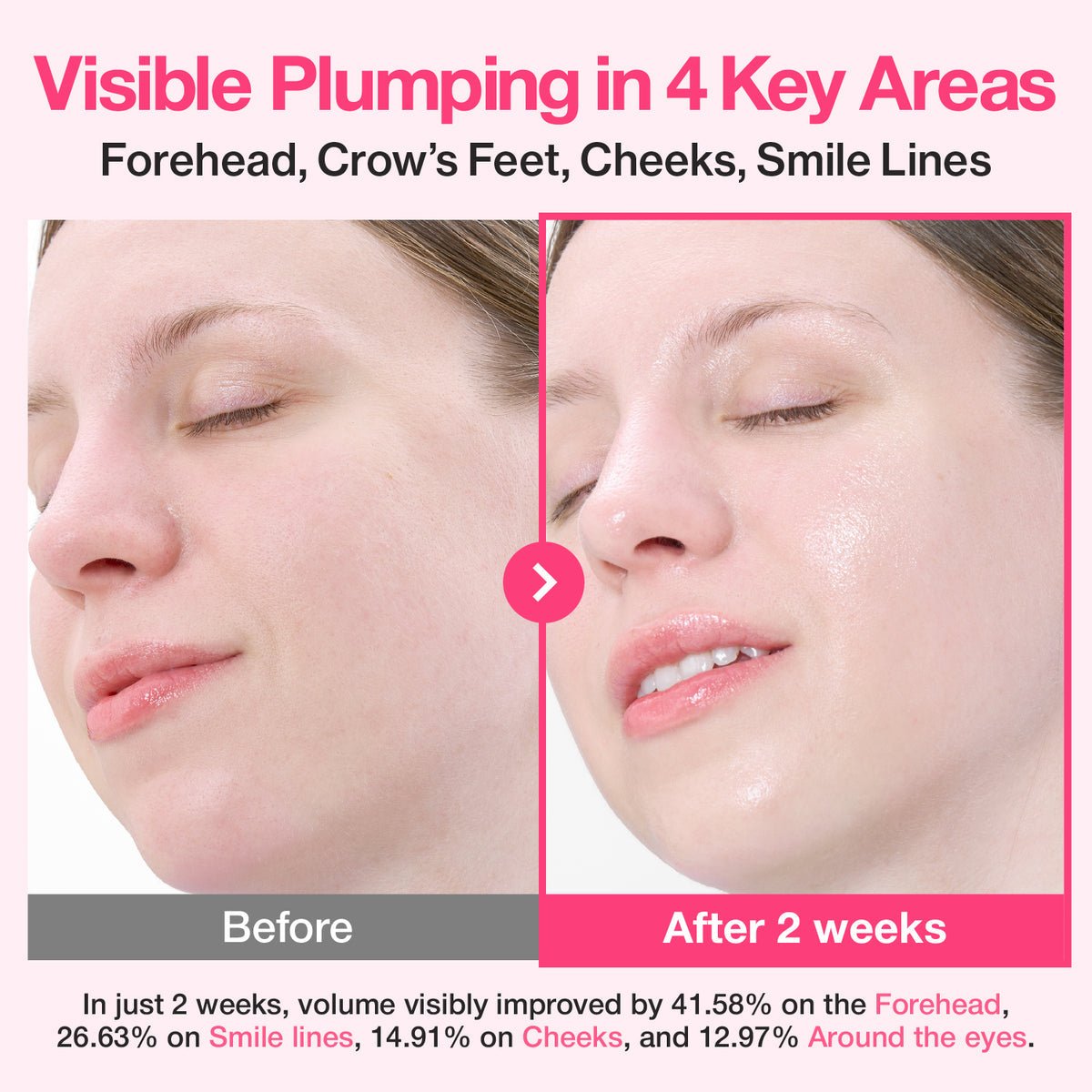 Numbuzin No.2 Rose PDRN Collagen Plumping Serum - OVERRATED
